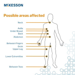 Silver Antimicrobial Moisture Wicking Fabric Roll - Non-Sterile Skin Protectant for Wound Care & Skin Fold Management