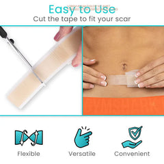 Silicone Scar Tape