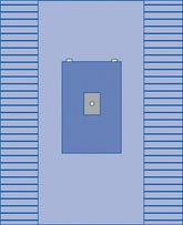 Medline Minor Extremity Pack, Sirus Surgical Drape Kit - Sterile 9-Piece Set for Orthopedic & Extremity Procedures (Case of 6)