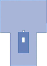 Medline Lithotomy Surgical Pack IV - Sterile SMS Surgical Drape Kit (Case of 10)