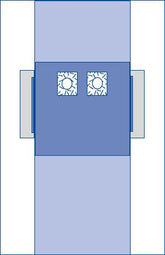 Femoral Angiography Surgical Drape with Dual Pouches - 77 x 135 Inch Premium SMS Barrier Protection