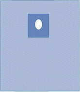 Sterile Special Procedure Drape 31x42 Inches - SMS Fabric - Case of 18