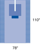 Sterile Universal Split Surgical Pack II - Complete Surgical Drape Kit with Reinforced Table Cover (Case of 7)