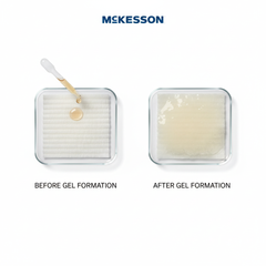 Gel transformation comparison