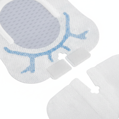 Securement System Close-up