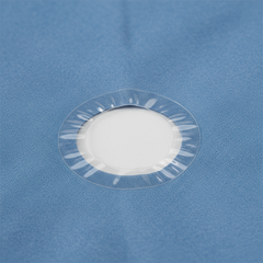 Close-up of circular fenestration