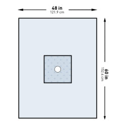 McKesson Surgical Minor Procedure Drape - SMS Fabric with Adhesive Fenestration