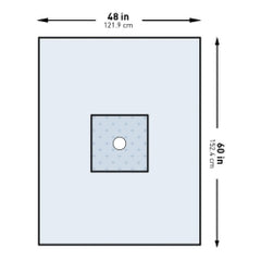 McKesson Surgical Minor Procedure Drape - SMS Fabric with Adhesive Fenestration