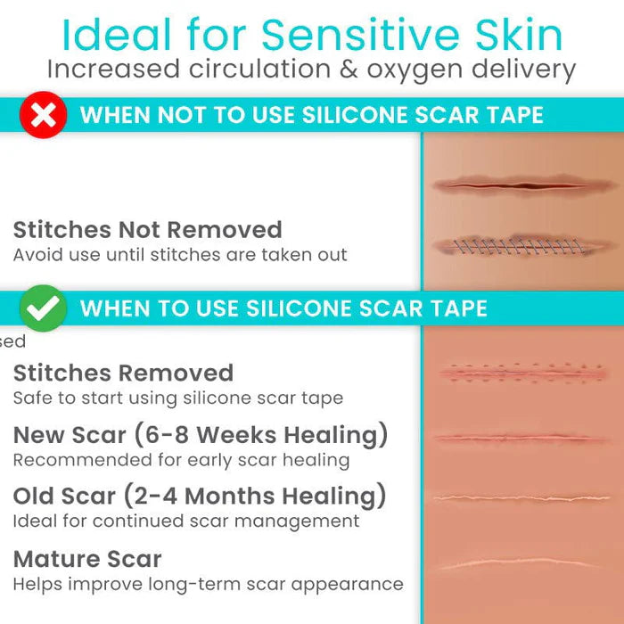 Silicone Scar Tape
