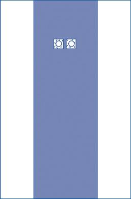 Medline Femoral Angio Drape 80 x 135 Inches - Premium SMS Surgical Drape (Case of 40)