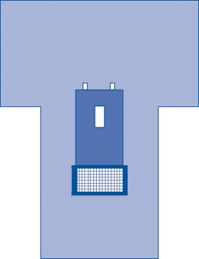 Medline Sterile Cystoscopy Surgical Pack VI - Complete Procedure Kit with Reinforced Drapes