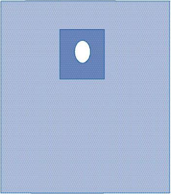 Sterile Special Procedure Drape 31x42 Inches - SMS Fabric - Case of 18