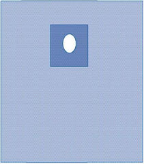 Sterile Special Procedure Drape 31x42 Inches - SMS Fabric - Case of 18