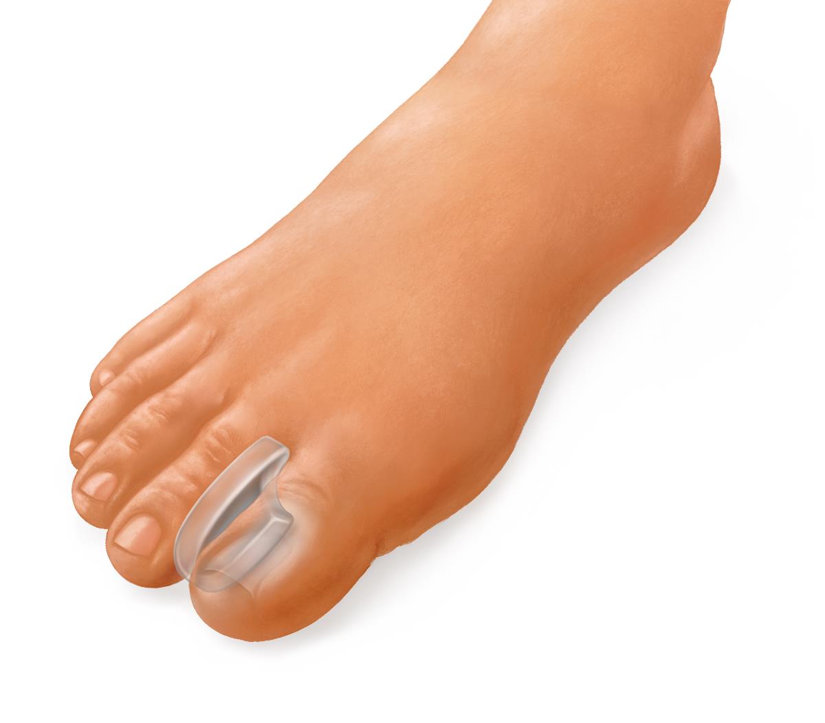 Medline Gel Toe Separators - Hypoallergenic Bunion Relief & Toe Alignment Corrector (Washable & Reusable)