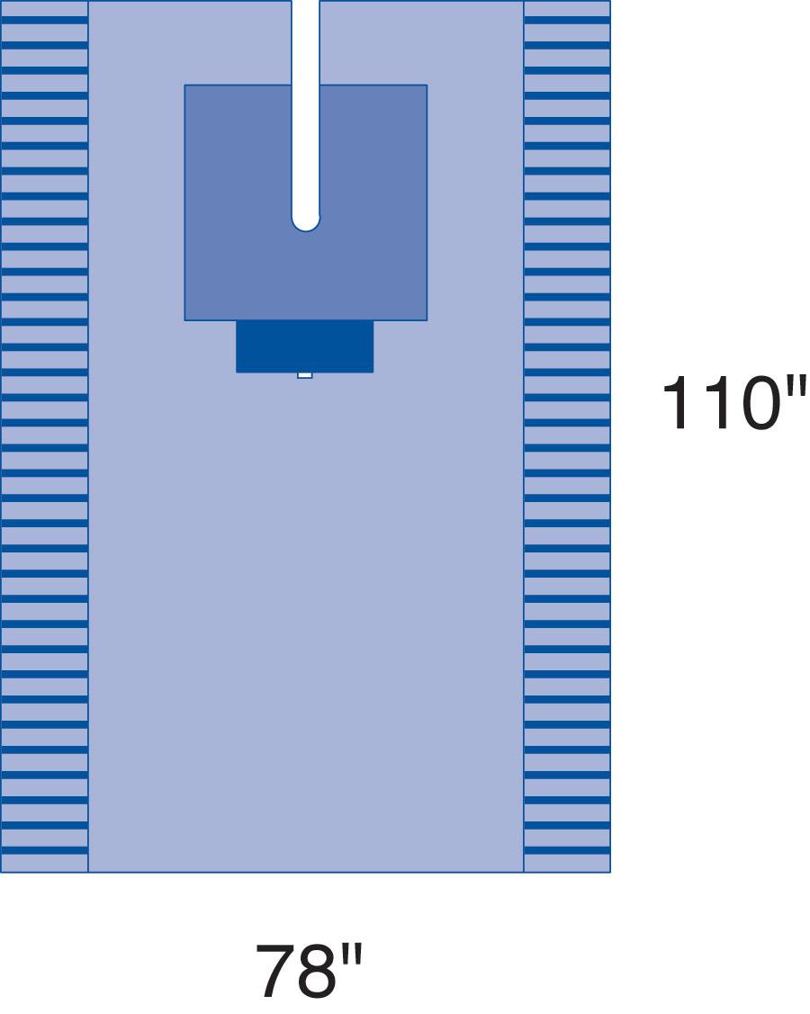 Sterile Universal Split Surgical Pack II - Complete Surgical Drape Kit with Reinforced Table Cover (Case of 7)
