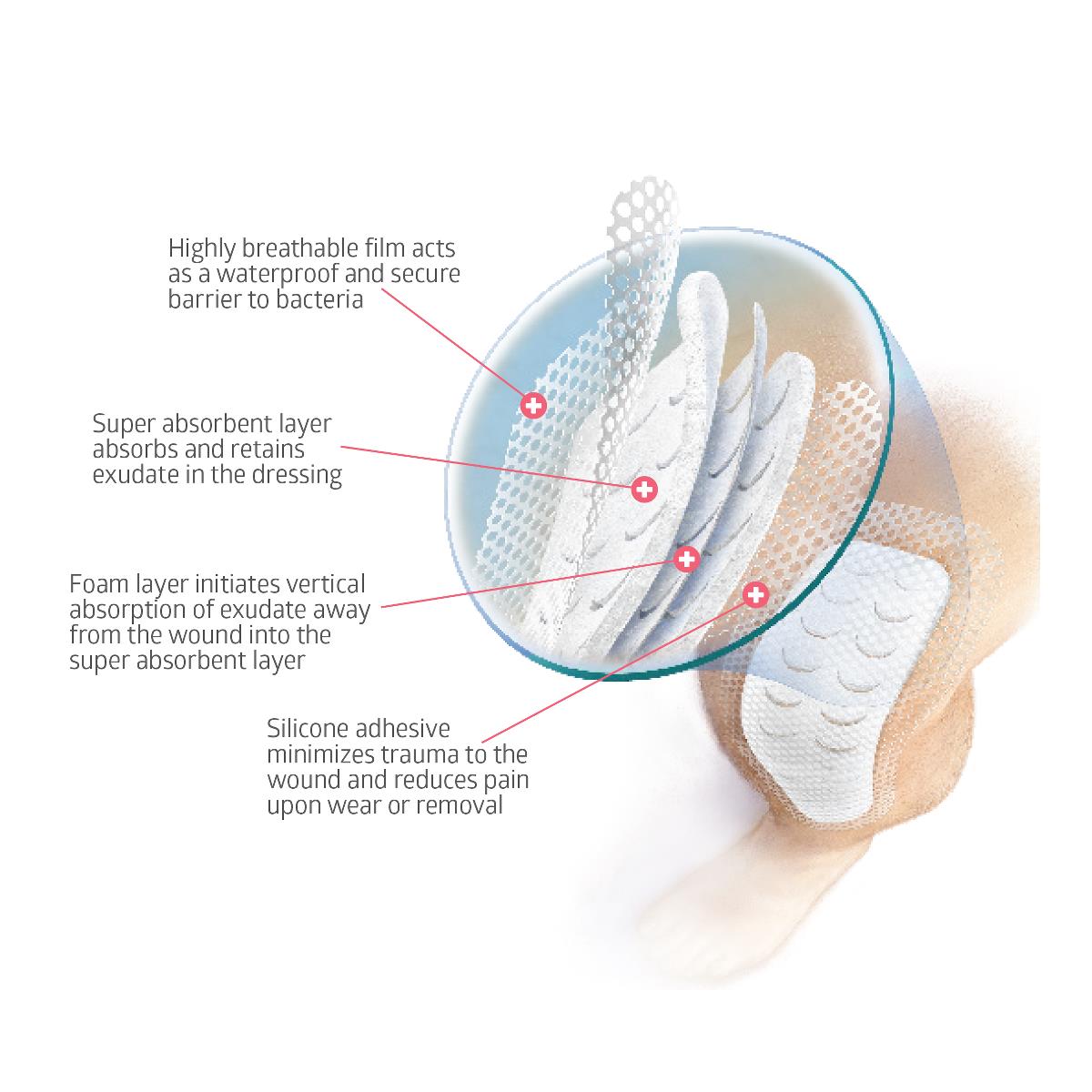 Optifoam Gentle Post-Op Silicone-Faced Foam Dressing - Sterile Wound Care with Smart Stretch Technology