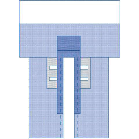 Sterile CV Split Surgical Drape with Clear Anesthesia Pouch - Premium 5-Layer SMS Barrier Protection