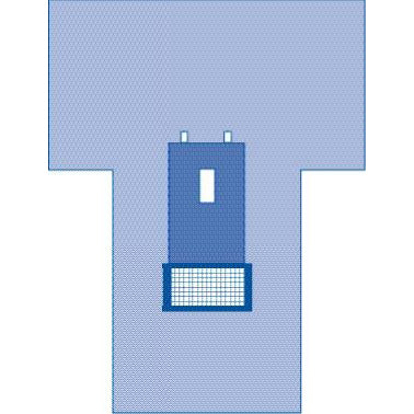 Cystoscopy Pack III with Sirus Poly-Reinforced Gown - Sterile Procedure Kit (Case of 8)