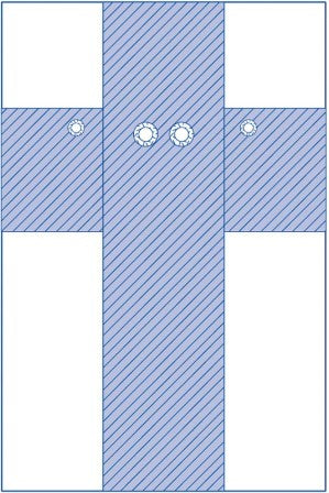 Medline Femoral Angiography Drape with Radial Fenestrations and Absorbent Reinforcement - 86 x 148 Inches (Case of 5)