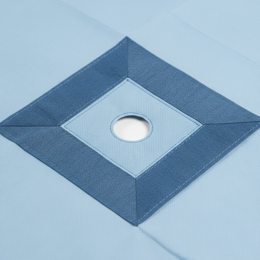 Close-up of fenestration