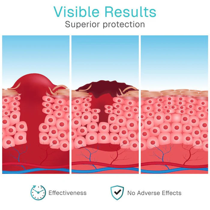 HydroGel Wound Gel