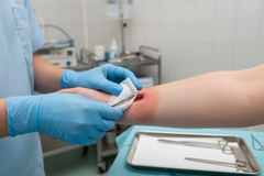 Equos Calcium Alginate Wound Dressing - Sterile, High Absorbency for Moderate to Heavy Drainage