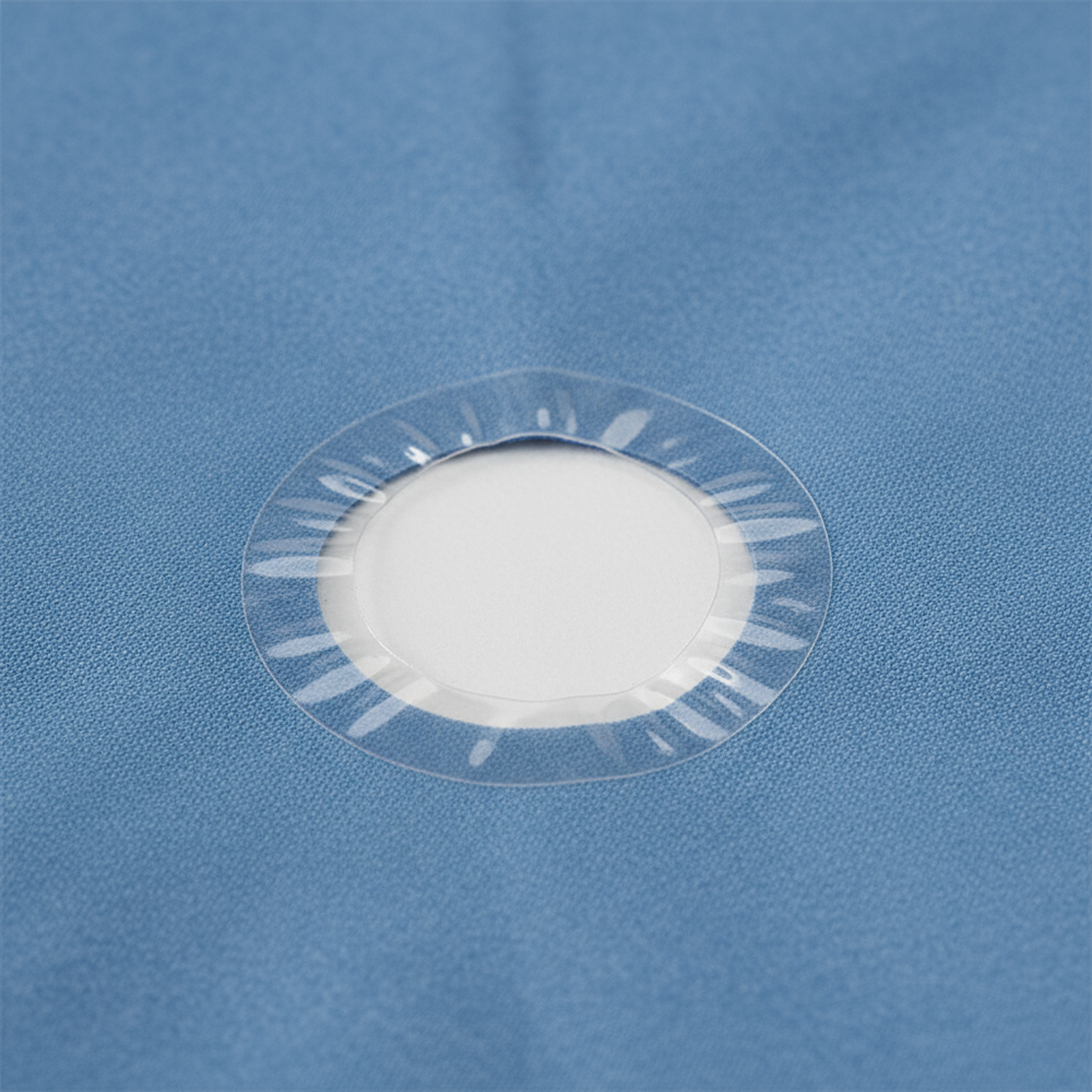 Close-up of circular fenestration